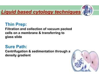 Liquid based cytology techniques
Thin Prep:
Filtration and collection of vacuum packed
cells on a membrane & transferring to
glass slide
Sure Path:
Centrifugation & sedimentation through a
density gradient
 