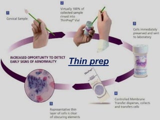 Thin prep
 