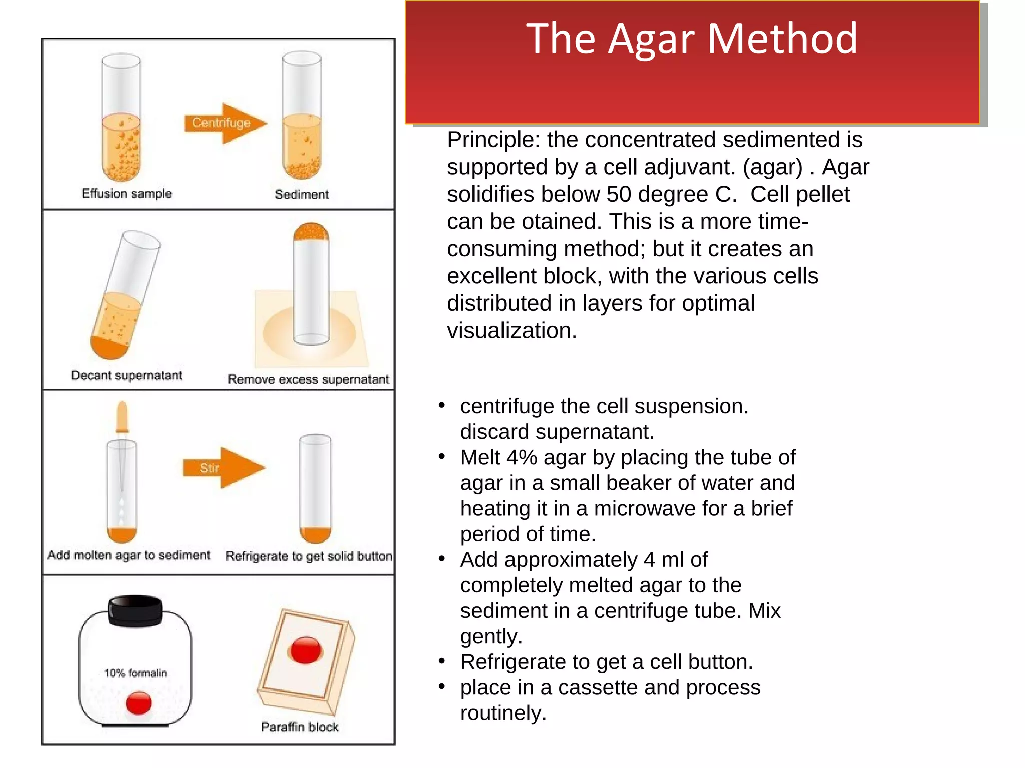 • centrifuge the cell suspension.
discard supernatant.
• Melt 4% agar by placing the tube of
agar in a small beaker of water and
heating it in a microwave for a brief
period of time.
• Add approximately 4 ml of
completely melted agar to the
sediment in a centrifuge tube. Mix
gently.
• Refrigerate to get a cell button.
• place in a cassette and process
routinely.
Principle: the concentrated sedimented is
supported by a cell adjuvant. (agar) . Agar
solidifies below 50 degree C. Cell pellet
can be otained. This is a more time-
consuming method; but it creates an
excellent block, with the various cells
distributed in layers for optimal
visualization.
The Agar MethodThe Agar Method
 