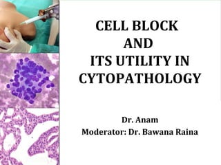 CELL BLOCK
AND
ITS UTILITY IN
CYTOPATHOLOGY
CELL BLOCK
AND
ITS UTILITY IN
CYTOPATHOLOGY
Dr. Anam
Moderator: Dr. Bawana Raina
Dr. Anam
Moderator: Dr. Bawana Raina
 