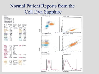 Normal Patient Reports from the
Cell Dyn Sapphire
27
 