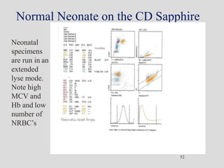 Normal Neonate on the CD Sapphire
Neonatal
specimens
are run in an
extended
lyse mode.
Note high
MCV and
Hb and low
number of
NRBC’s
52
 