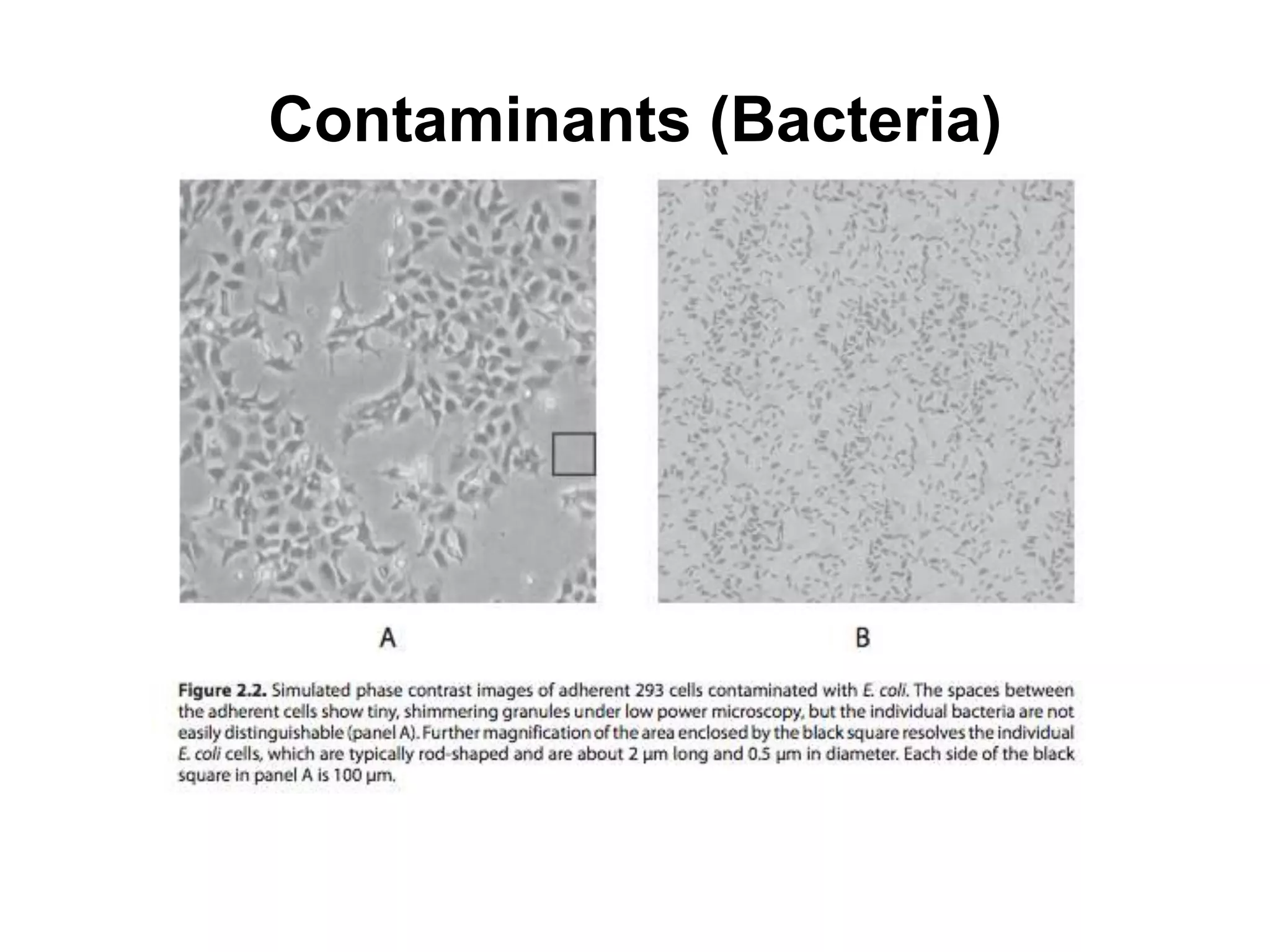 Contaminants (Bacteria)
 