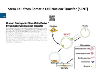 Stem Cell from Somatic Cell Nuclear Transfer (SCNT)

 