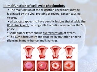 III.malfunction of cell cycle checkpoints
• The malfunction of the restriction checkpoint may be
facilitated by the viral proteins of several cancer-causing
viruses,
• all cancers appear to have genetic lesions that disable the
G1-S checkpoint, causing cells to continually reenter the S
phase.
• some tumer types shows overexpression of cyclins
• The CDKIs frequently are disabled by mutation or gene
silencing in many human malignancies.
 