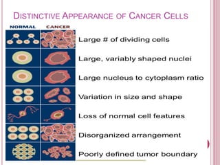 DISTINCTIVE APPEARANCE OF CANCER CELLS
 