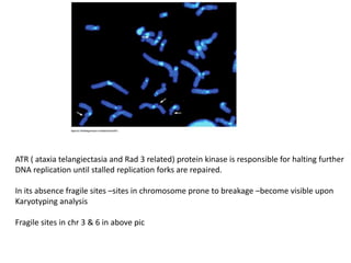 ATR ( ataxia telangiectasia and Rad 3 related) protein kinase is responsible for halting further
DNA replication until stalled replication forks are repaired.
In its absence fragile sites –sites in chromosome prone to breakage –become visible upon
Karyotyping analysis
Fragile sites in chr 3 & 6 in above pic
 