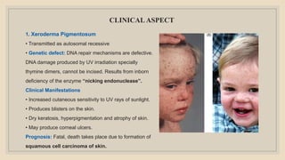 CLINICAL ASPECT
1. Xeroderma Pigmentosum
• Transmitted as autosomal recessive
• Genetic defect: DNA repair mechanisms are defective.
DNA damage produced by UV irradiation specially
thymine dimers, cannot be incised. Results from inborn
deficiency of the enzyme “nicking endonuclease”.
Clinical Manifestations
• Increased cutaneous sensitivity to UV rays of sunlight.
• Produces blisters on the skin.
• Dry keratosis, hyperpigmentation and atrophy of skin.
• May produce corneal ulcers.
Prognosis: Fatal, death takes place due to formation of
squamous cell carcinoma of skin.
 