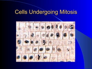 Cells Undergoing Mitosis 