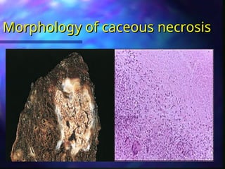 Caceous Cell death.ppt at isamic university in Uganda | PPT