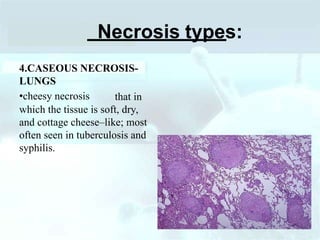 cell death. microbiology easy 2nd year ppt | PPT