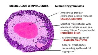 Cell death - Necrosis, apoptosis, autolysis, cellular aging | PPTX