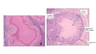 Cell death - Necrosis, apoptosis, autolysis, cellular aging | PPTX