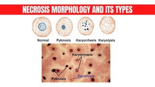 Cell death - Necrosis, apoptosis, autolysis, cellular aging | PPTX