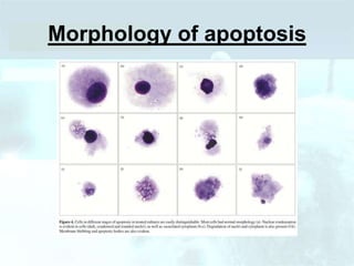 Morphology of apoptosis
 
