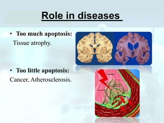 Role in diseases
• Too much apoptosis:
Tissue atrophy.
• Too little apoptosis:
Cancer, Atherosclerosis.
 