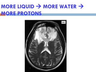 MORE LIQUID  MORE WATER 
MORE PROTONS
 