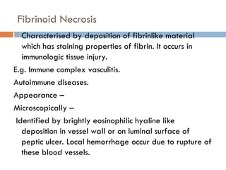 Fibrinoid Necrosis
 Characterised by deposition of fibrinlike material
which has staining properties of fibrin. It occurs in
immunologic tissue injury.
E.g. Immune complex vasculitis.
Autoimmune diseases.
Appearance –
Microscopically –
Identified by brightly eosinophilic hyaline like
deposition in vessel wall or on luminal surface of
peptic ulcer. Local hemorrhage occur due to rupture of
these blood vessels.
 