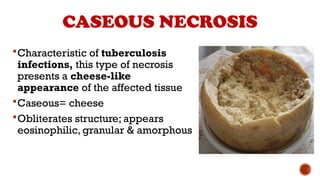 Cell death and Necrosis - Types - S.pptx