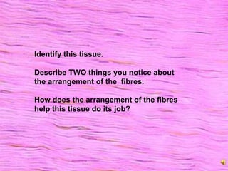 Identify this tissue.
Describe TWO things you notice about
the arrangement of the fibres.
How does the arrangement of the fibres
help this tissue do its job?
 