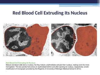 Red Blood Cell Extruding Its Nucleus
Red Blood Cell Extruding Its Nucleus
Mature red blood cells lack a nucleus. As they mature, erythroblasts extrude their nucleus, making room for more
hemoglobin. The two panels here show an erythroblast before and after ejecting its nucleus, respectively. (credit:
modification of micrograph provided by the Regents of University of Michigan Medical School © 2012)
.
 
