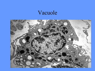 Vacuole
 
