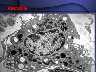 Vacuole 
 