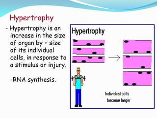 Hypertrophy
- Hypertrophy is an
increase in the size
of organ by + size
of its individual
cells, in response to
a stimulus or injury.
-RNA synthesis.
 