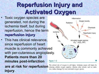 Reperfusion Injury andReperfusion Injury and
Activated OxygenActivated Oxygen
• Toxic oxygen species are
generated, not during the
ischemia itself, but during
reperfusion, hence the term
reperfusion injuryreperfusion injury
• This has clinical relevance,
since reperfusion of heart
muscle is commonly achieved
with per-cutaneous angioplasty.
Patients more than 20
minutes post-infarction
are at risk for reperfusion
injury.
 