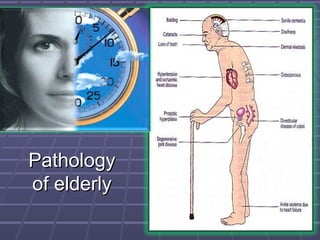 PathologyPathology
of elderlyof elderly
 