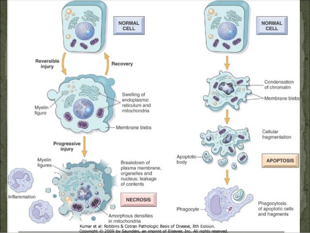 Cell Injury Cell Injury
