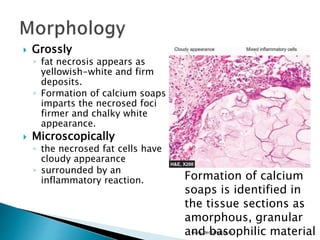  Grossly
◦ fat necrosis appears as
yellowish-white and firm
deposits.
◦ Formation of calcium soaps
imparts the necrosed foci
firmer and chalky white
appearance.
 Microscopically
◦ the necrosed fat cells have
cloudy appearance
◦ surrounded by an
inflammatory reaction.
www.dentaltutot.in
Formation of calcium
soaps is identified in
the tissue sections as
amorphous, granular
and basophilic material
 