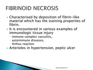  Characterised by deposition of fibrin-like
material which has the staining properties of
fibrin.
 It is encountered in various examples of
immunologic tissue injury
◦ immune complex vasculitis,
◦ autoimmune diseases,
◦ Arthus reaction
 Arterioles in hypertension, peptic ulcer
www.dentaltutot.in
 