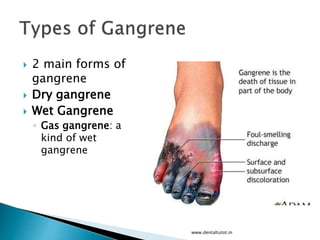  2 main forms of
gangrene
 Dry gangrene
 Wet Gangrene
◦ Gas gangrene: a
kind of wet
gangrene
www.dentaltutot.in
 