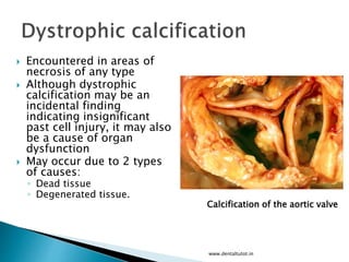  Encountered in areas of
necrosis of any type
 Although dystrophic
calcification may be an
incidental finding
indicating insignificant
past cell injury, it may also
be a cause of organ
dysfunction
 May occur due to 2 types
of causes:
◦ Dead tissue
◦ Degenerated tissue.
www.dentaltutot.in
Calcification of the aortic valve
 