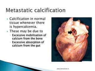  Calcification in normal
tissue whenever there
is hypercalcemia.
 These may be due to
◦ Excessive mobilisation of
calcium from the bone
◦ Excessive absorption of
calcium from the gut
www.dentaltutot.in
 