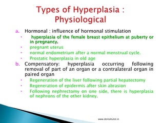 a. Hormonal : influence of hormonal stimulation
 hyperplasia of the female breast epithelium at puberty or
in pregnancy.
 pregnant uterus
 normal endometrium after a normal menstrual cycle.
 Prostatic hyperplasia in old age
b. Compensatory: hyperplasia occurring following
removal of part of an organ or a contralateral organ in
paired organ
 Regeneration of the liver following partial hepatectomy
 Regeneration of epidermis after skin abrasion
 Following nephrectomy on one side, there is hyperplasia
of nephrons of the other kidney.
www.dentaltutot.in
 