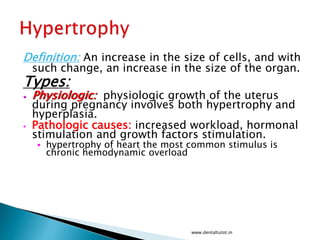 Definition: An increase in the size of cells, and with
such change, an increase in the size of the organ.
Types:
• Physiologic: physiologic growth of the uterus
during pregnancy involves both hypertrophy and
hyperplasia.
• Pathologic causes: increased workload, hormonal
stimulation and growth factors stimulation.
• hypertrophy of heart the most common stimulus is
chronic hemodynamic overload
www.dentaltutot.in
 
