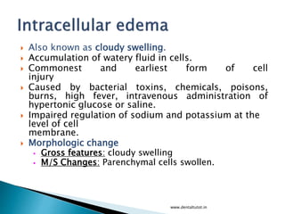  Also known as cloudy swelling.
 Accumulation of watery fluid in cells.
 Commonest and earliest form of cell
injury
 Caused by bacterial toxins, chemicals, poisons,
burns, high fever, intravenous administration of
hypertonic glucose or saline.
 Impaired regulation of sodium and potassium at the
level of cell
membrane.
 Morphologic change
• Gross features: cloudy swelling
• M/S Changes: Parenchymal cells swollen.
www.dentaltutot.in
 