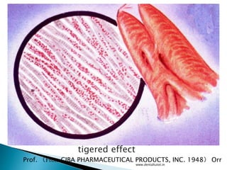 tigered effect
Prof. （From CIBA PHARMACEUTICAL PRODUCTS, INC. 1948） Orr
www.dentaltutot.in
 