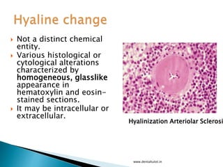 Not a distinct chemical
entity.
 Various histological or
cytological alterations
characterized by
homogeneous, glasslike
appearance in
hematoxylin and eosin-
stained sections.
 It may be intracellular or
extracellular.
www.dentaltutot.in
Hyalinization Arteriolar Sclerosi
 