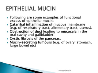 Following are some examples of functional
excess of epithelial mucin:
 Catarrhal inflammation of mucous membrane
(e.g. of respiratory tract, alimentary tract, uterus).
 Obstruction of duct leading to mucocele in the
oral cavity and gallbladder.
 Cystic fibrosis of the pancreas.
 Mucin-secreting tumours (e.g. of ovary, stomach,
large bowel etc)
www.dentaltutot.in
 