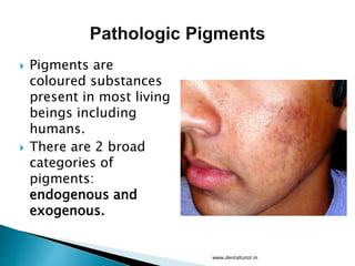  Pigments are
coloured substances
present in most living
beings including
humans.
 There are 2 broad
categories of
pigments:
endogenous and
exogenous.
www.dentaltutot.in
 