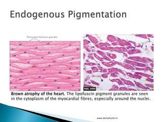 www.dentaltutot.in
Brown atrophy of the heart. The lipofuscin pigment granules are seen
in the cytoplasm of the myocardial fibres, especially around the nuclei.
 