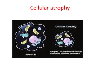 Cell injury-morphology | PPT