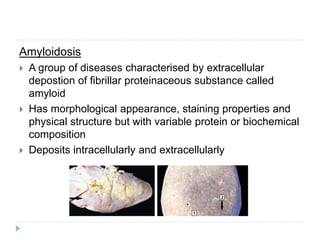 Amyloidosis
 A group of diseases characterised by extracellular
depostion of fibrillar proteinaceous substance called
amyloid
 Has morphological appearance, staining properties and
physical structure but with variable protein or biochemical
composition
 Deposits intracellularly and extracellularly
 