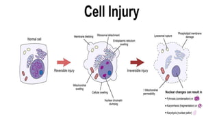 Cell injury | PPTX