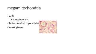 megamitochondria
• ALD
• Steatohepatitits
• Mitochondrial myopathies
• oncocytoma
 