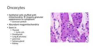 Oncocytes
• Epithelial cells stuffed with
mitochondria  imparts granular
appearance to cytoplasm
• Granular pinkish
• Abundant megamitochondria
• Seen in
• Thyroid
• Hurtle cells
• Parathyroid
• Lung & pituitary
• pancreas
• Salivary gland
• Kidney
 