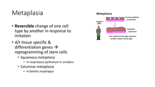 Metaplasia
• Reversible change of one cell
type by another in response to
irritation
• d/t tissue specific &
differentiation genes 
reprogramming of stem cells
• Squamous metaplasia
• In respiratory epithelium in smokers
• Columnar metaplasia
• In baretts esophagus
 